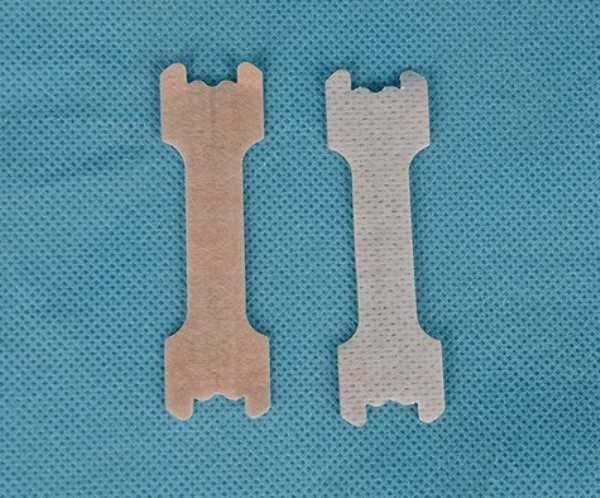 Nasal Strips
